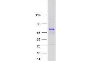 Validation with Western Blot
