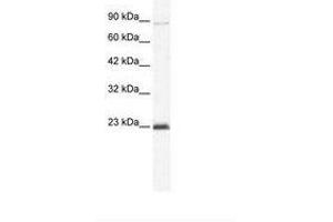 Image no. 1 for anti-Minichromosome Maintenance Deficient 4 (MCM4) (C-Term) antibody (ABIN203262) (MCM4 anticorps  (C-Term))