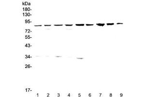Western blot testing of human 1) HeLa, 2) 293T, 3) MCF7, 4) COLO320, 5) 22RV1 6) SK-OV-3, 7) rat stomach, 8) rat liver and 9) mouse liver lysate wtih CD2AP antibody at 0. (CD2AP anticorps)