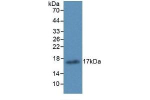 Detection of Recombinant ALOX15, Human using Monoclonal Antibody to Arachidonate-15-Lipoxygenase (ALOX15) (ALOX15 anticorps  (AA 170-312))