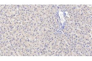 Detection of MAPRE1 in Human Liver Tissue using Monoclonal Antibody to Microtubule Associated Protein RP/EB Family, Member 1 (MAPRE1) (MAPRE1 anticorps  (AA 2-268))