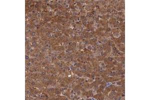 Immunohistochemistry (Formalin/PFA-fixed paraffin-embedded sections) of human liver with PLEK2 polyclonal antibody  shows strong cytoplasmic positivity in hepatocytes. (Pleckstrin 2 anticorps)