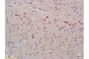 Formalin-fixed and paraffin embedded rat brain labeled with Anti-ANP Polyclonal Antibody, Unconjugated (ABIN676928) at 1:200, followed by conjugation to the secondary antibody and DAB staining (NPPA anticorps  (AA 124-151))