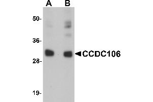 Western Blotting (WB) image for anti-Coiled-Coil Domain Containing 106 (CCDC106) (C-Term) antibody (ABIN1030324) (CCDC106 anticorps  (C-Term))
