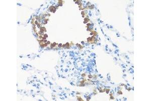 Immunohistochemistry of paraffin-embedded Mouse lung using FGF10 Polyclonal Antibody at dilution of 1:100 (40x lens). (FGF10 anticorps)