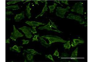 Immunofluorescence of monoclonal antibody to TIMP2 on HeLa cell. (TIMP2 anticorps  (AA 27-220))