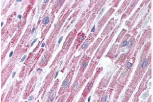 Human Heart (formalin-fixed, paraffin-embedded) stained with TIRAP antibody ABIN213995 at 2 ug/ml followed by biotinylated goat anti-rabbit IgG secondary antibody ABIN481713, alkaline phosphatase-streptavidin and chromogen. (TIRAP anticorps  (C-Term))