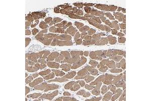 Immunohistochemical staining of human heart muscle with CCDC80 polyclonal antibody  shows moderate cytoplasmic positivity in myocytes at 1:50-1:200 dilution. (CCDC80 anticorps)