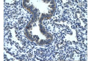 Rabbit Anti-RGS19 Antibody       Paraffin Embedded Tissue:  Human bronchiole epithelium   Cellular Data:  Epithelial cells of renal tubule  Antibody Concentration:   4.