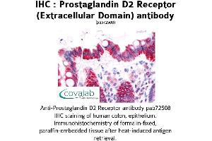 Image no. 1 for anti-Prostaglandin D2 Receptor (PTGDR) (3rd Extracellular Domain) antibody (ABIN1738421)
