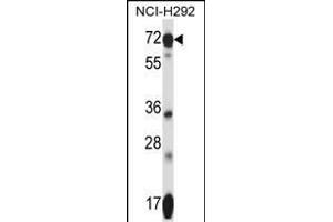 SLC41A2 Antibody (N-term) (ABIN657753 and ABIN2846735) western blot analysis in NCI- cell line lysates (35 μg/lane). (SLC41A2 anticorps  (N-Term))