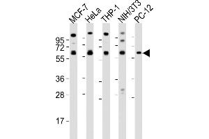 All lanes : Anti-PKM2 antibody at 1:2000 dilution Lane 1: MCF-7 whole cell lysates Lane 2: Hela whole cell lysates Lane 3: THP-1 whole cell lysates Lane 4: NIH/3T3 whole cell lysates Lane 5: PC-12 whole cell lysates Lysates/proteins at 20 μg per lane.