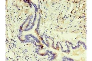 Immunohistochemistry of paraffin-embedded human lung using ABIN7140933 in 30 μg/mL dilute concentrations. (CD14 anticorps)