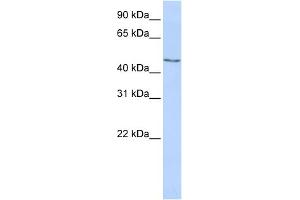 WB Suggested Anti-MECP2 Antibody Titration:  0. (MECP2 anticorps  (Middle Region))