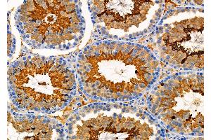 ABIN6265691 and ABIN6276606 at 1/100 staining Mouse testis tissue by IHC-P. (TPM3 anticorps  (N-Term))