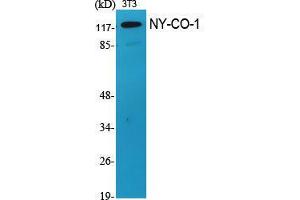 Western Blot (WB) analysis of specific cells using NY-CO-1 Polyclonal Antibody.
