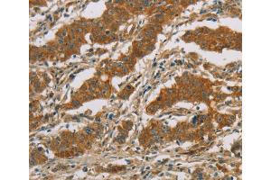 Immunohistochemistry (IHC) image for anti-Cytochrome P450, Family 39, Subfamily A, Polypeptide 1 (CYP39A1) antibody (ABIN2423239) (CYP39A1 anticorps)