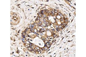 IHC analysis of IRBIT/AHCYL1 using anti-IRBIT/AHCYL1 antibody (ABIN7600030). (AHCYL1 anticorps  (AA 14-57))
