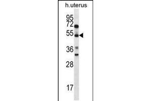 Western blot analysis in human normal Uterus tissue lysates (35ug/lane). (ABRA anticorps  (C-Term))