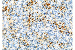 ABIN6257051 and ABIN6274616 at 1/100 staining Rat kidney tissue by IHC-P. (CDCA3 anticorps  (C-Term))