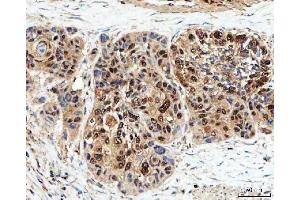IHC analysis of SDE2 using anti-SDE2 antibody (ABIN7599603). (C1orf55 anticorps  (AA 10-447))