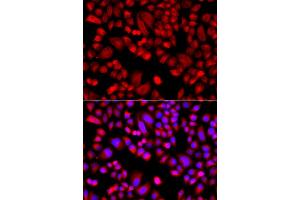 Immunofluorescence analysis of A549 cells using ARPC3 antibody. (ARPC3 anticorps)