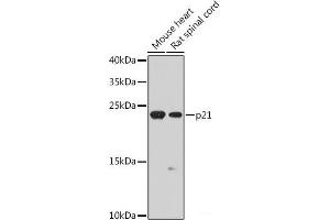 Western blot analysis of extracts of various cell lines using p21 Polyclonal Antibody at dilution of 1:1000. (p21 anticorps)