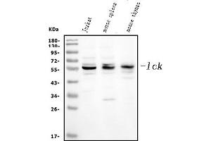Western blot analysis of Lck using anti-Lck antibody (ABIN3043870).