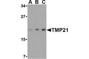 Western blot analysis of TMP21 in mouse brain tissue lysate with this product at (A) 0.