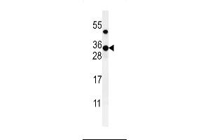 Western blot analysis of ZCH24 Antibody (C-term) (ABIN651036 and ABIN2840043) in CHO cell line lysates (35 μg/lane). (ZCCHC24 anticorps  (C-Term))