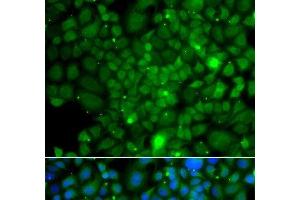 Immunofluorescence analysis of A549 cells using RRAGA Polyclonal Antibody (RRAGA anticorps)