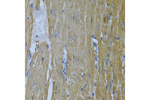 Immunohistochemistry of paraffin-embedded mouse heart using  Antibody (ABIN6127328, ABIN6136696, ABIN6136697 and ABIN6217467) at dilution of 1:100 (40x lens). (Adenylate Kinase 1 anticorps  (AA 1-194))