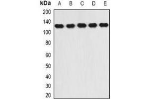 Western blot analysis of RANBP5 expression in SW620 (A), Hela (B), HepG2 (C), mouse heart (D), mouse brain (E) whole cell lysates.