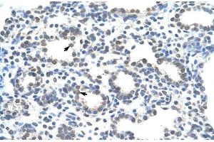 Human Lung; ZRANB2 antibody - middle region in Human Lung cells using Immunohistochemistry