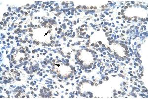 Human Lung; ZRANB2 antibody - middle region in Human Lung cells using Immunohistochemistry (ZNF265 anticorps  (Isoform 2, Middle Region))