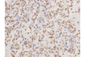 Immunohistochemistry (Paraffin-embedded Sections) (IHC (p)) image for anti-Protein Kinase, DNA-Activated, Catalytic Polypeptide (PRKDC) (Catalytic Subunit) antibody (ABIN1112714)