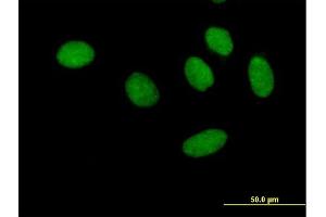 Immunofluorescence of purified MaxPab antibody to GTF2F1 on HeLa cell.