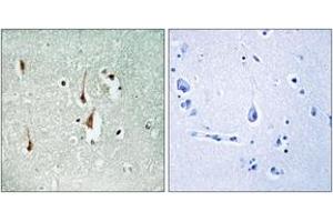 Immunohistochemistry analysis of paraffin-embedded human brain tissue, using Cyclin D1 (Ab-286) Antibody.