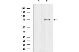 anti-Thyroid Stimulating Hormone Receptor (TSHR) (Internal Region) antibody