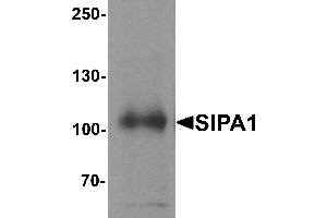 Western blot analysis of SIPA1 in human brain tissue lysate with SIPA1 antibody at 1 µg/mL. (SIPA1 anticorps  (N-Term))