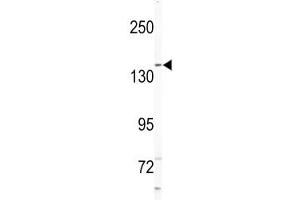 Western blot analysis of NIK antibody and Jurkat lysate.