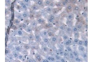 Detection of GLRX in Mouse Liver Tissue using Polyclonal Antibody to Glutaredoxin (GLRX)