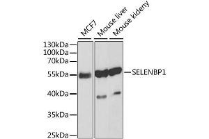 Western blot analysis of extracts of various cell lines, using SELENBP1 antibody.