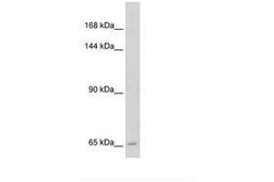 Image no. 2 for anti-Solute Carrier Family 19 (Folate Transporter), Member 1 (SLC19A1) (N-Term) antibody (ABIN205031)