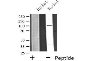 Western blot analysis of extracts from 293 cells, using USP11 antibody. (USP11 anticorps  (Internal Region))