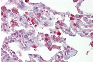 Anti-FOSL1 / FRA1 antibody IHC staining of human lung. (FOSL1 anticorps  (AA 143-192))