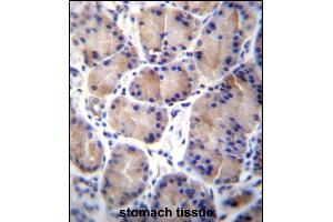 CES8 Antibody (C-term) (ABIN656888 and ABIN2846087) immunohistochemistry analysis in formalin fixed and paraffin embedded human stomach tissue followed by peroxidase conjugation of the secondary antibody and DAB staining. (CES4A anticorps  (C-Term))