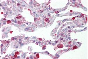 Immunohistochemistry with Lung tissue at an antibody concentration of 5µg/ml using anti-FOSL1 antibody (ARP31378_P050) (FOSL1 anticorps  (Middle Region))