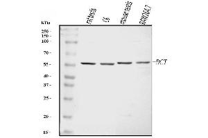 Western blot analysis of TRP2/DCT using anti-TRP2/DCT antibody (ABIN7600843).