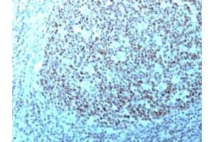 Formalin-fixed, paraffin-embedded human tonsil stained with Nucleolin antibody. (Nucleolin anticorps)